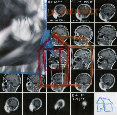 MRI Results  - a Photographic Art Artowrk by Hannah  Esquenazi