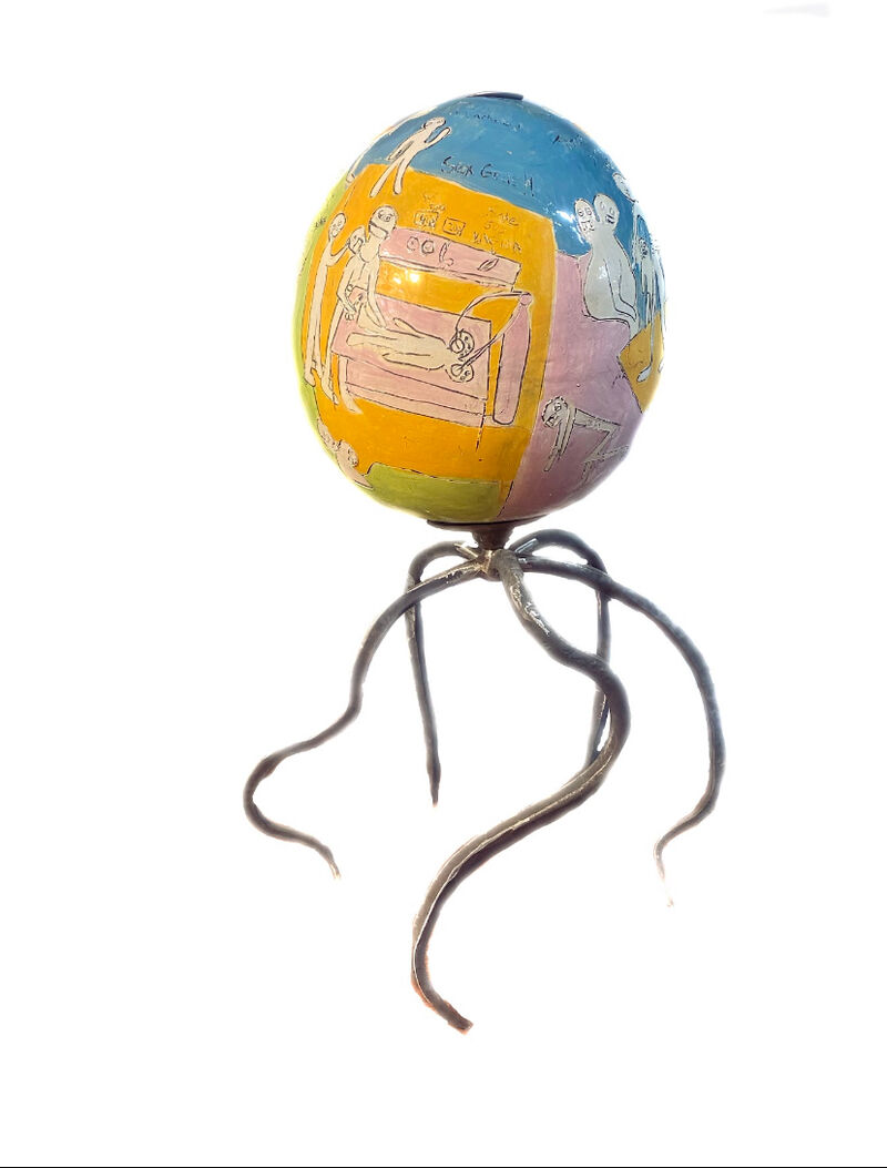 Fragile leg - a Sculpture & Installation by Uk