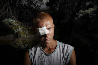 Man with Eye Injury, Ukraine 2011 - a Photographic Art Artowrk by RICHARD ANSETT