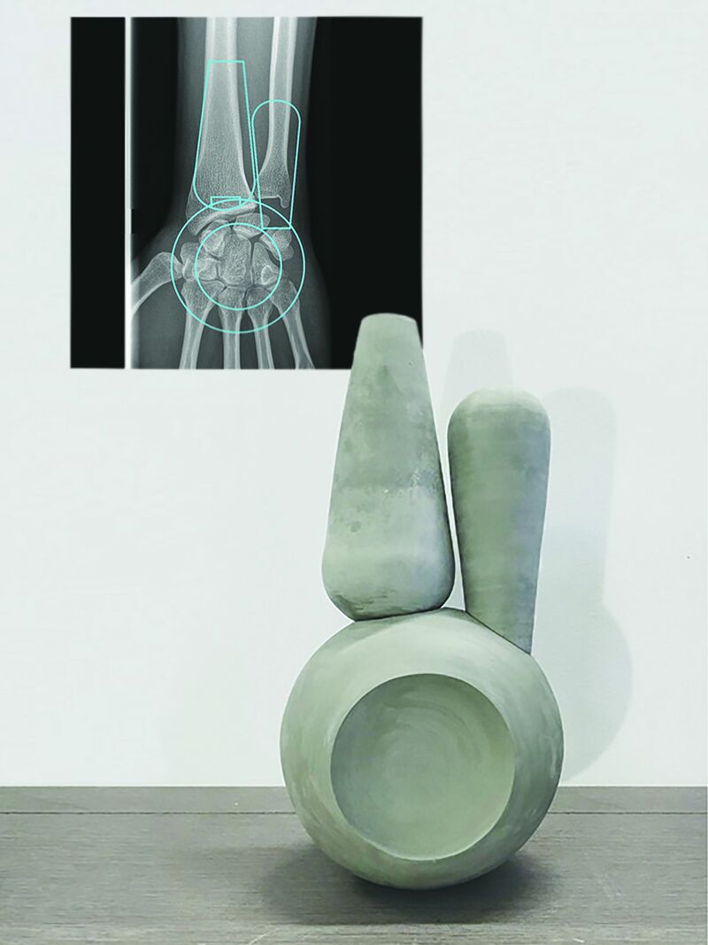 wrist - a Art Design by mCLp studio