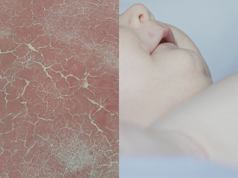 Germoglio - a Photographic Art by Chiara Cunzolo 