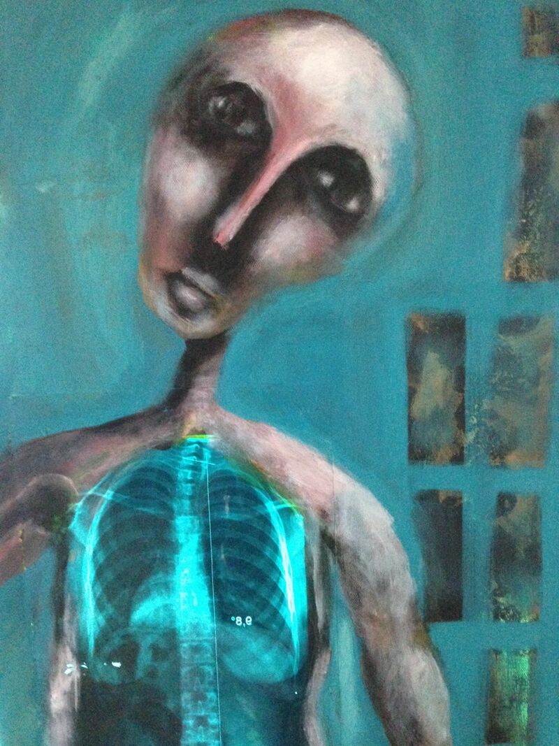 Thoracic - a Paint by Mathias Z